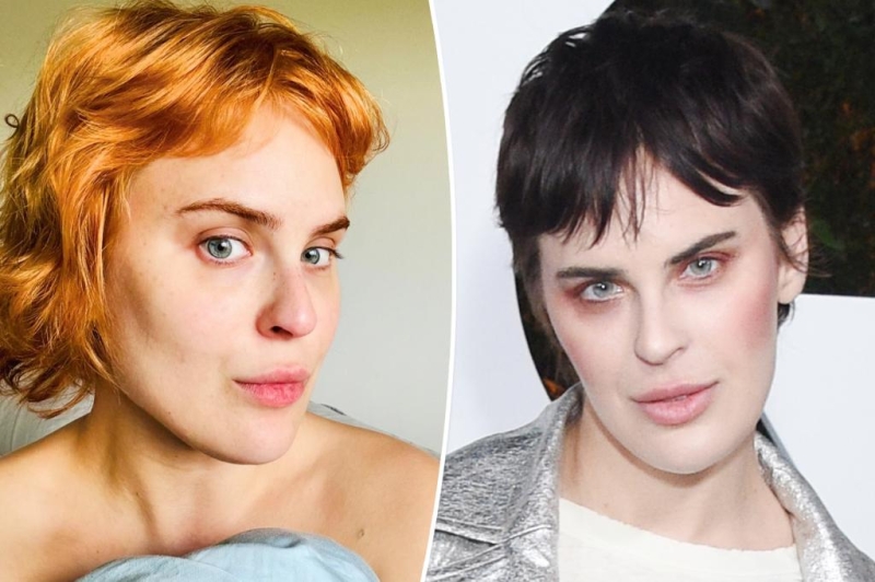 Tallulah Willis liquifies filler after 6 years, displays ‘genuine bone structure’