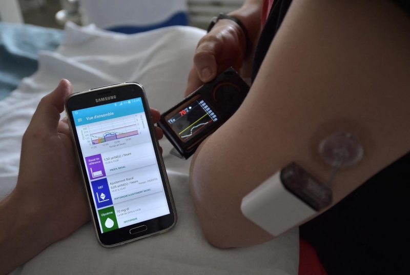 England’s NHS will offer synthetic pancreas to countless diabetes clients