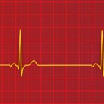 Severe Issues With Slow Heartbeat Flagged for Afib Patients on Antiarrhythmics