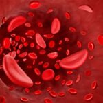 Sickle Cell Pain Hospitalizations Rose After CDC’s Opioid Recs