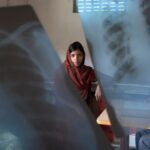 The Majority Of People With TB Report No Persistent Cough