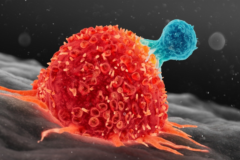 Researchers Found a Way to Supercharge Cancer-Fighting Cells